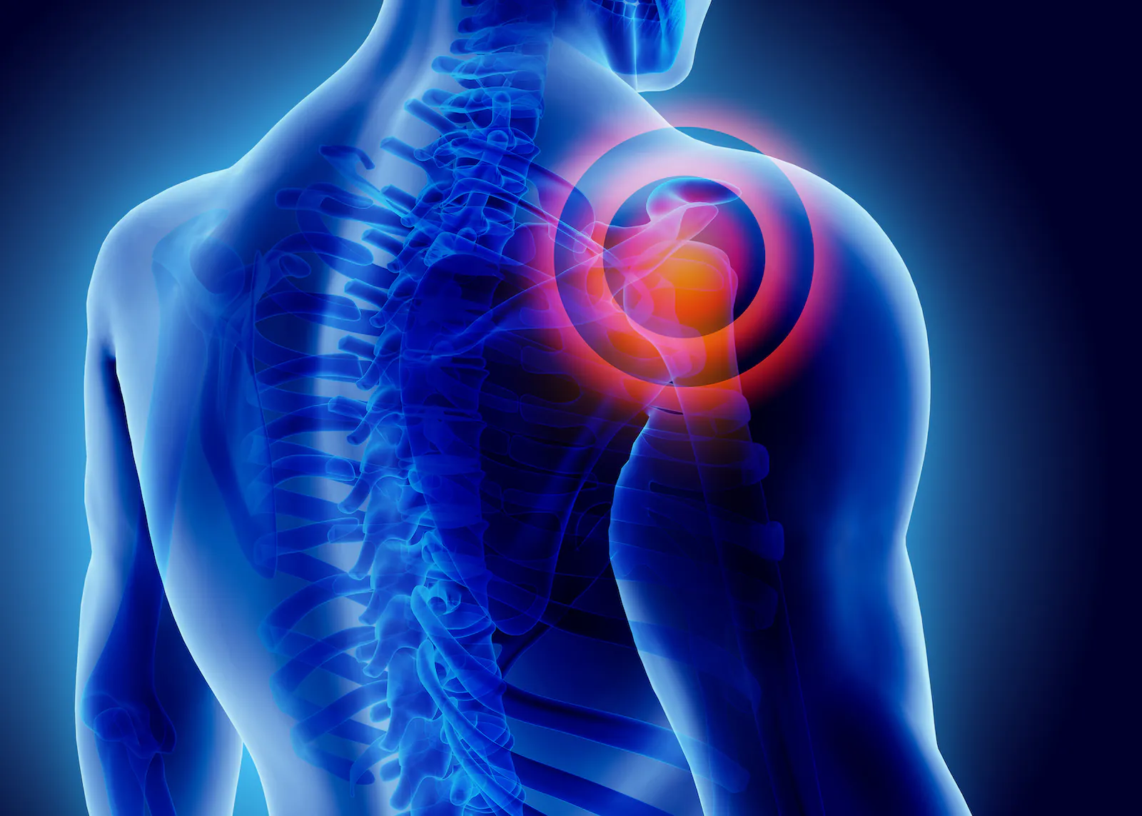 Rotator Cuff Therapy